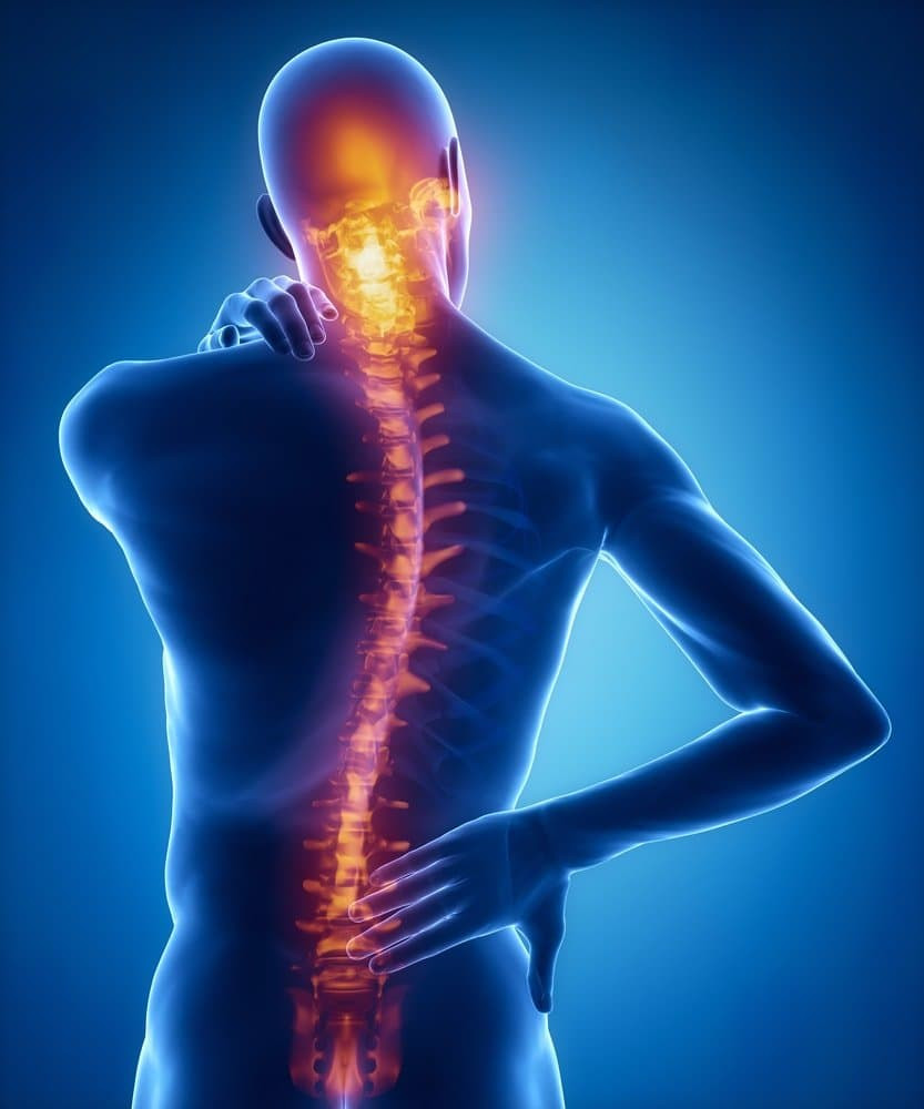 Trauma Medula Spinalis